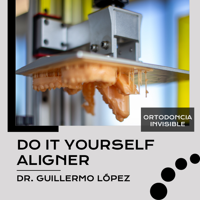 DO-IT-YOURSEL-ALIGNERS