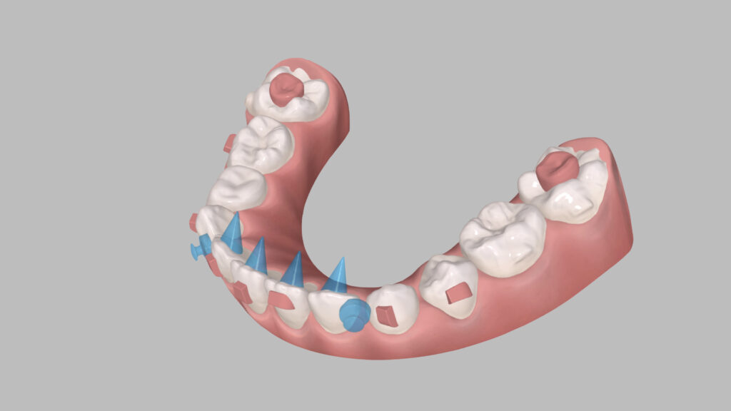 modelo 3d de la mandibula inferior